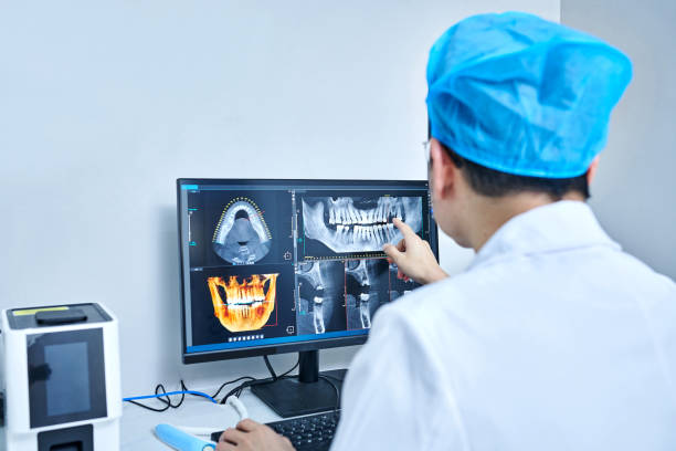 Best Dental Abscess Treatment in Paradise, CA